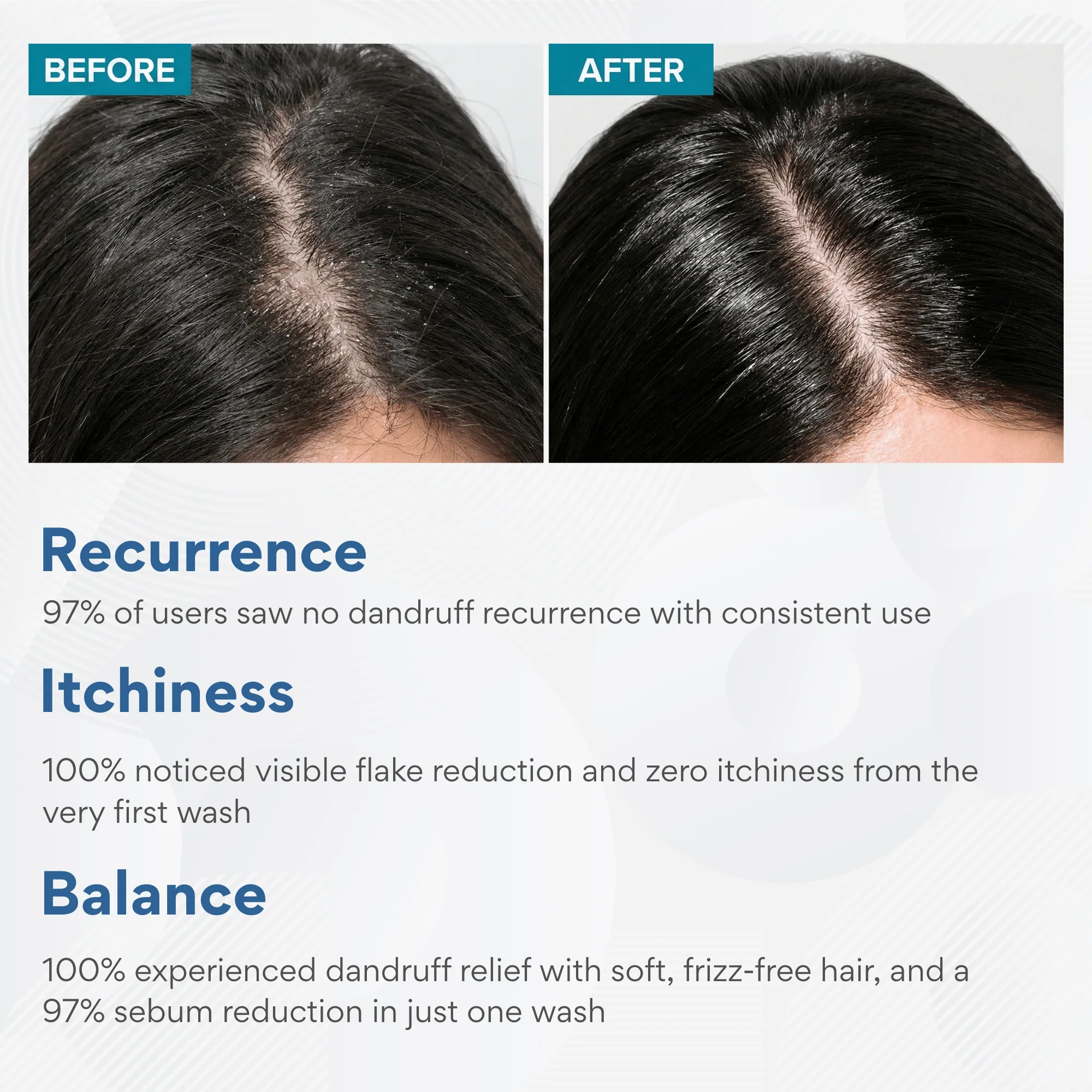 Anti-Dandruff Shampoo - Image 6