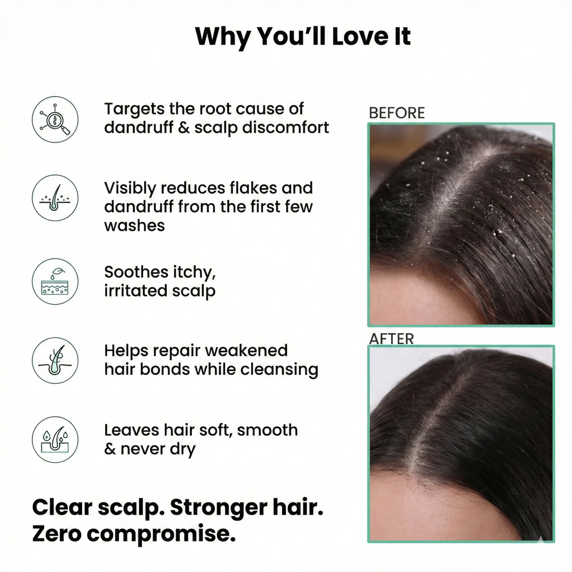 Anti-Dandruff Shampoo - Image 7